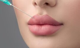 Why Russian Lip Fillers Treatments in Dubai Are Ideal for Mature Clients