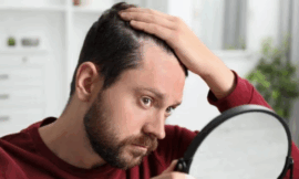 Eirion Achieves Success in First Human Trial of Topical Hair-Loss Treatment