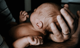 Spanish Babies Reportedly Develop ‘Werewolf Syndrome’ After Exposure to Hair-Loss Drug