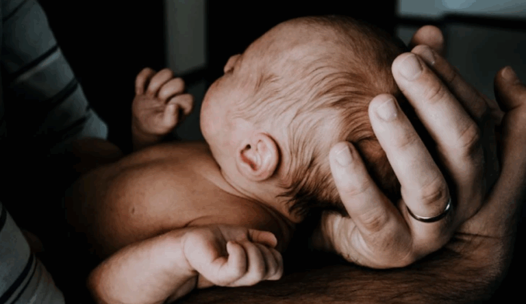 Read more about the article Spanish Babies Reportedly Develop ‘Werewolf Syndrome’ After Exposure to Hair-Loss Drug