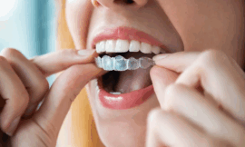 Your Path to a Perfect Smile Starts with a Trusted Orthodontist and Invisalign Clear Aligners