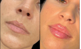 Discover the Leading Plastic Surgeon in Dubai