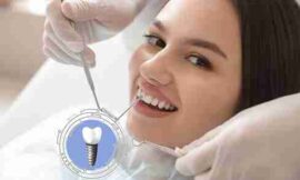 Stay Updated with the Latest Insights & Trends in Dental Implants