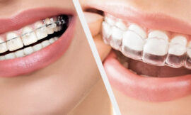 Safe Braces for Young Children: Are They Worth It?