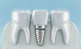 How Often Should You See a Dentist in Omagh?