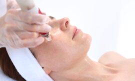 Is Microneedling Painful for Melasma Treatments?