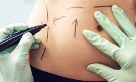 What Should I Eat in the First Month After Bariatric Surgery in Dubai