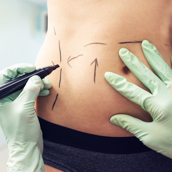 Read more about the article What Should I Eat in the First Month After Bariatric Surgery in Dubai