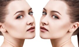 What Should You Expect During Your First Rhinoplasty Consultation in Dubai