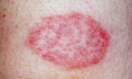 Why Is My Skin So Sensitive in Dubai, and What Can I Do About It