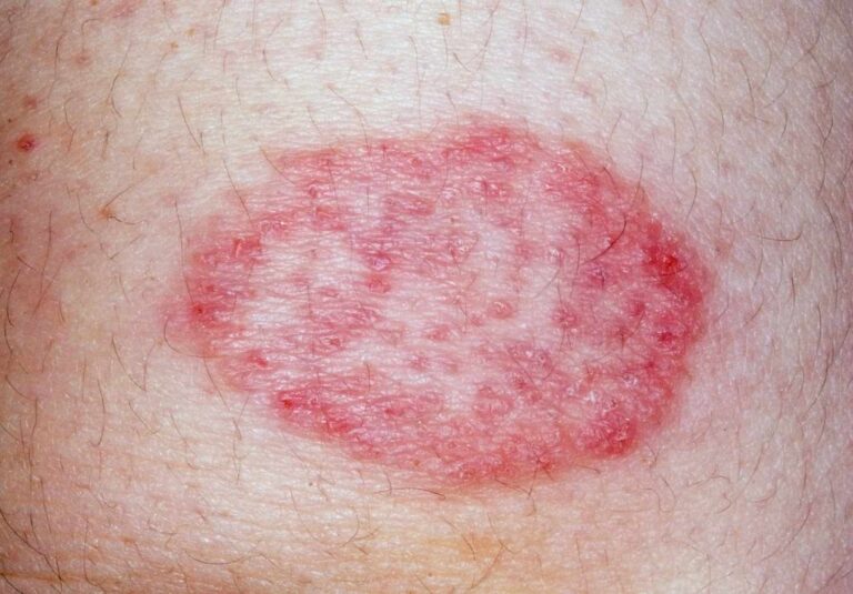 Read more about the article Why Is My Skin So Sensitive in Dubai, and What Can I Do About It
