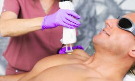 Why Laser Hair Removal Beats Shaving