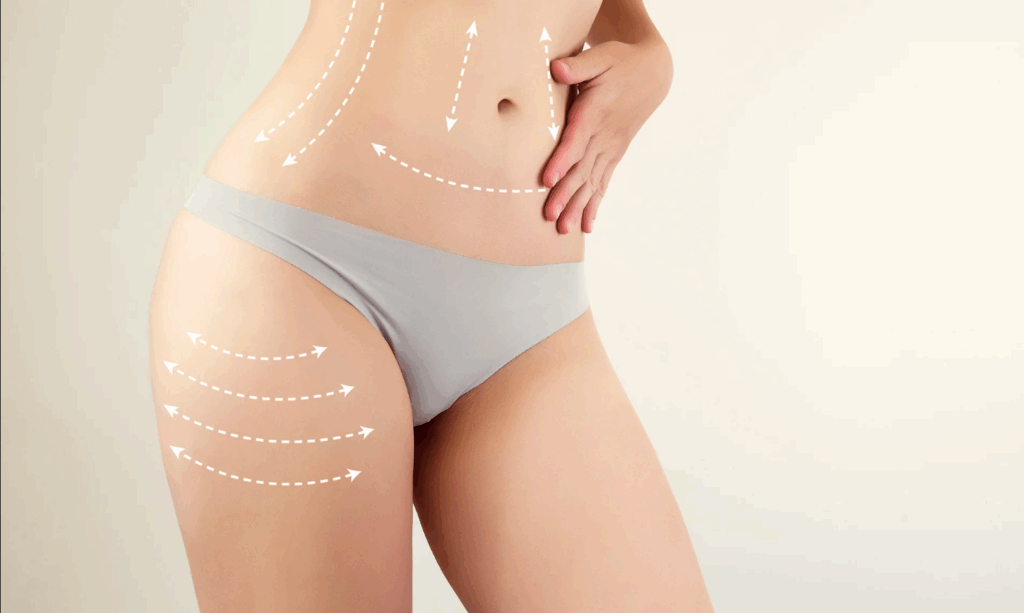 Best Liposuction Surgeons in Dubai