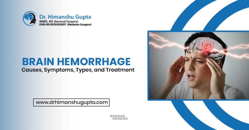 Understanding the Risks and Prevention of Brain Hemorrhage