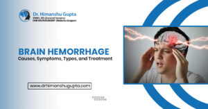 Understanding the Risks and Prevention of Brain Hemorrhage