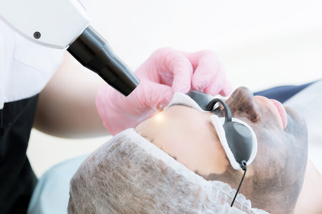 How Does Pico Laser Treatment Work for Skin Repair