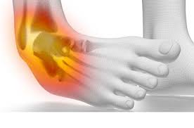 Sprains & Strains