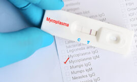 A Complete Guide to Managing Mgen Symptoms