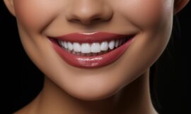 Can Teeth Whitening Improve Yellowing From Medication?