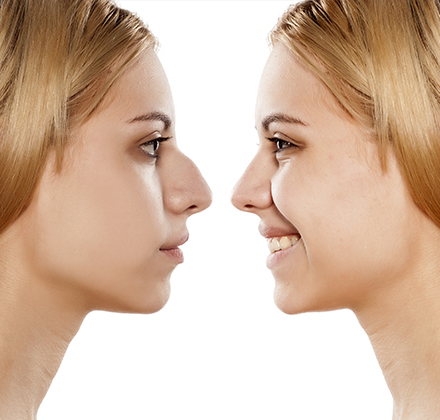 Read more about the article How Do I Know If I’m a Good Candidate for Rhinoplasty in Dubai?