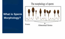Sperm Morphology: What Does It Mean for Male Fertility?