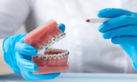 Why Experience Matters When Choosing an Orthodontist You Can Trust