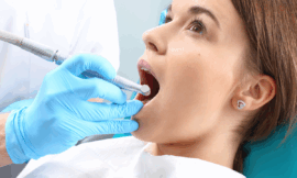 Root Canal Treatment Explained: What It Is and Why You Might Need One
