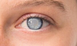 Why You Shouldn’t Delay Retina Treatment