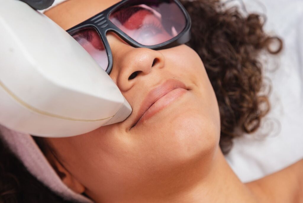 Laser Hair Removal Cost