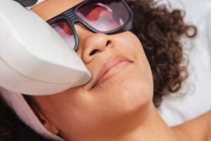 Laser Hair Removal Cost