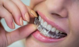 How Invisalign Can Boost Your Confidence Without the Wires