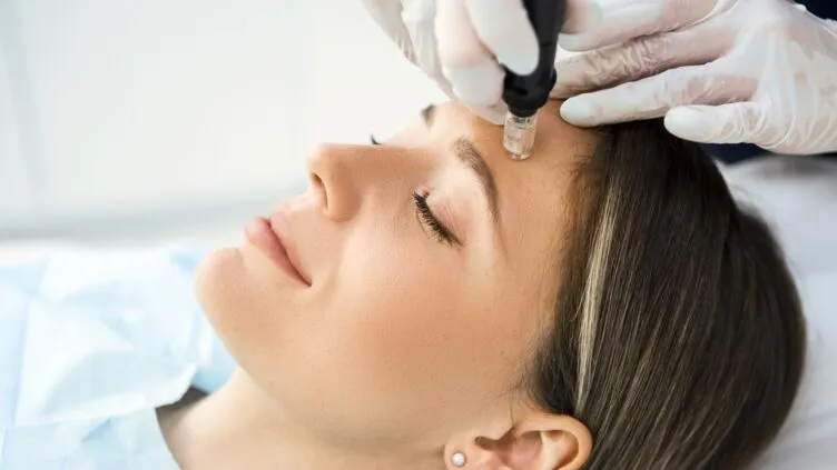Professional Microneedling Services Available