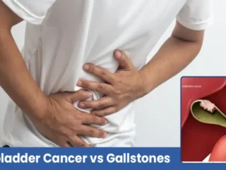 Gallbladder-Cancer
