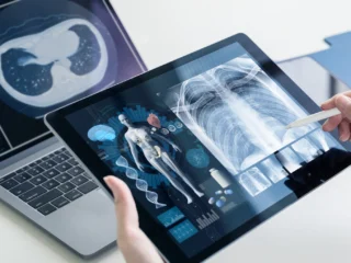 Teleradiology-services