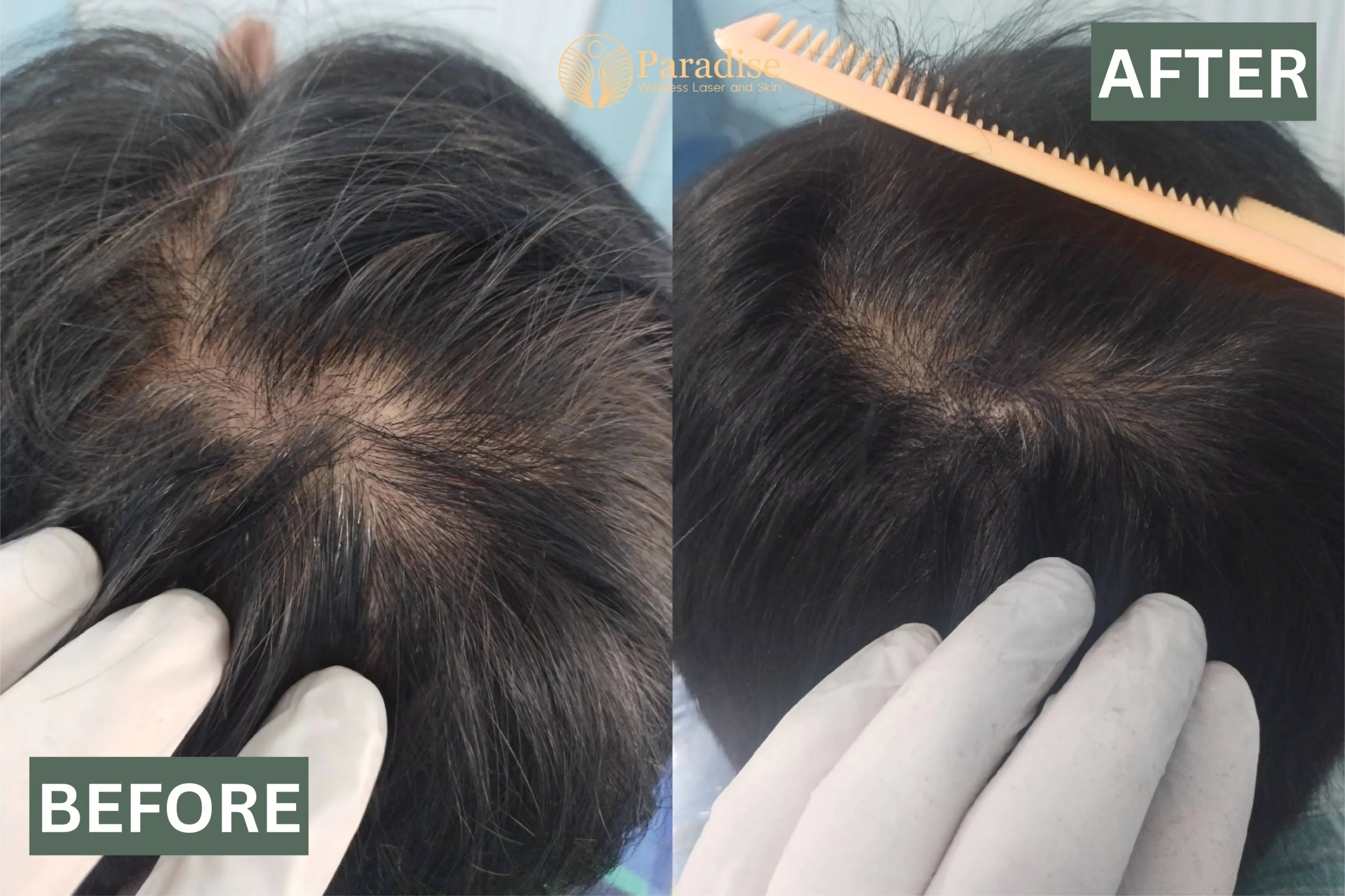 Healthy Skin & Strong Hair Start Here: Your Guide to the Best Skin Clinic Gurgaon & PRP Hair Treatment in Gurgaon