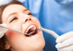 Root Canal Treatment Cost in Noida