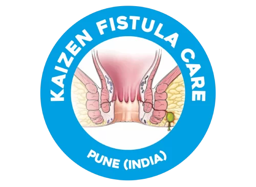 Kaizen Fistula Care – Fistula surgeon | Best Fistula Specialist in Pune, India | Fistula Treatment in Pune