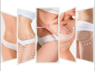 Med-Esthetiks_Types-of-Body-Lift-Procedures_13