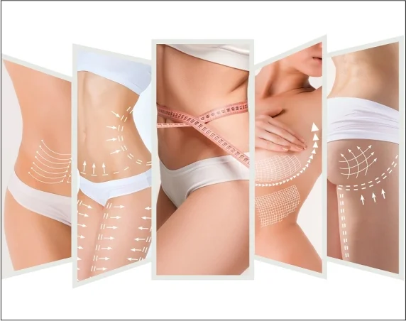 Body contouring surgery in Delhi By Med Esthetiks