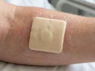 foam-wound-dressing