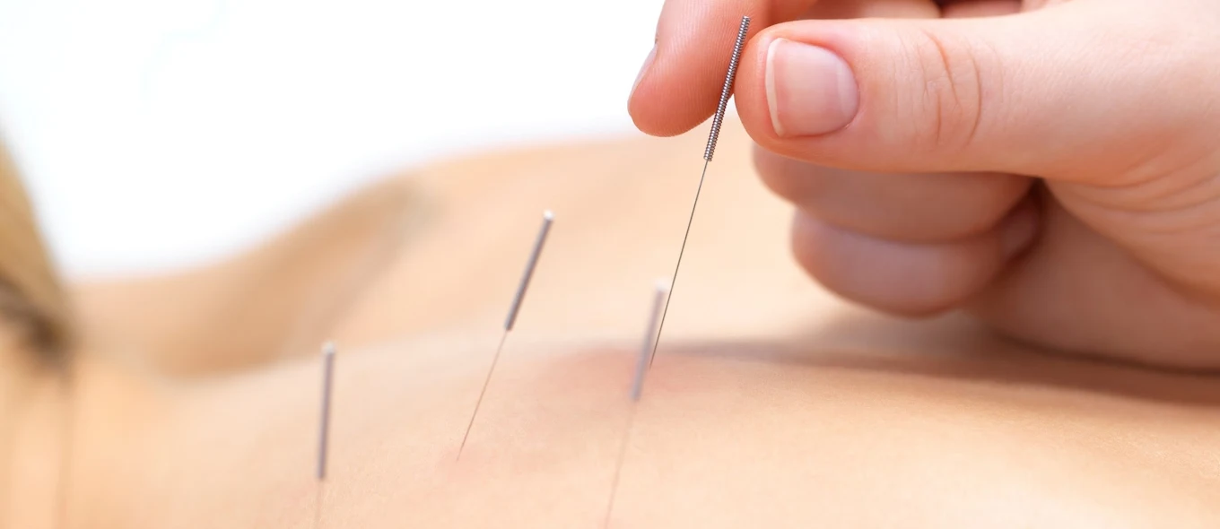 Peel Back Care Clinic – Dry Needling & Remedial Massage