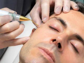 plasma-Removal-by-Skin-and-Tonic-in-Pace-FL-scaled-1
