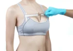 Perimeter Plastic Surgery