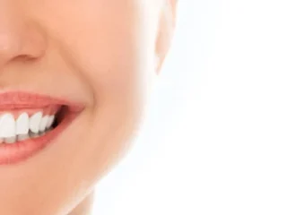Ceramic-Dental-Implants