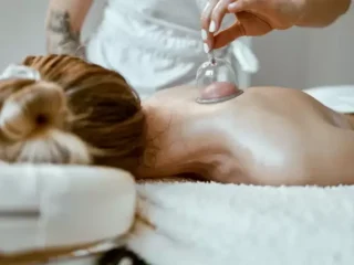 Cupping-Therapy-768×432-1