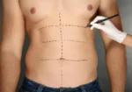 Perimeter Plastic Surgery