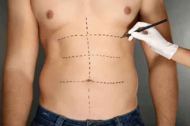 Perimeter Plastic Surgery