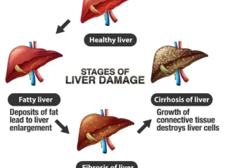 liver-2.jpg